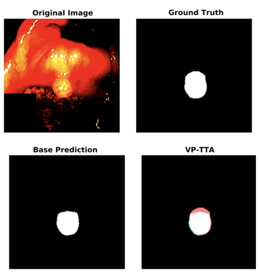 Polyp segmentation before and after visual-prompt test-time adaptation